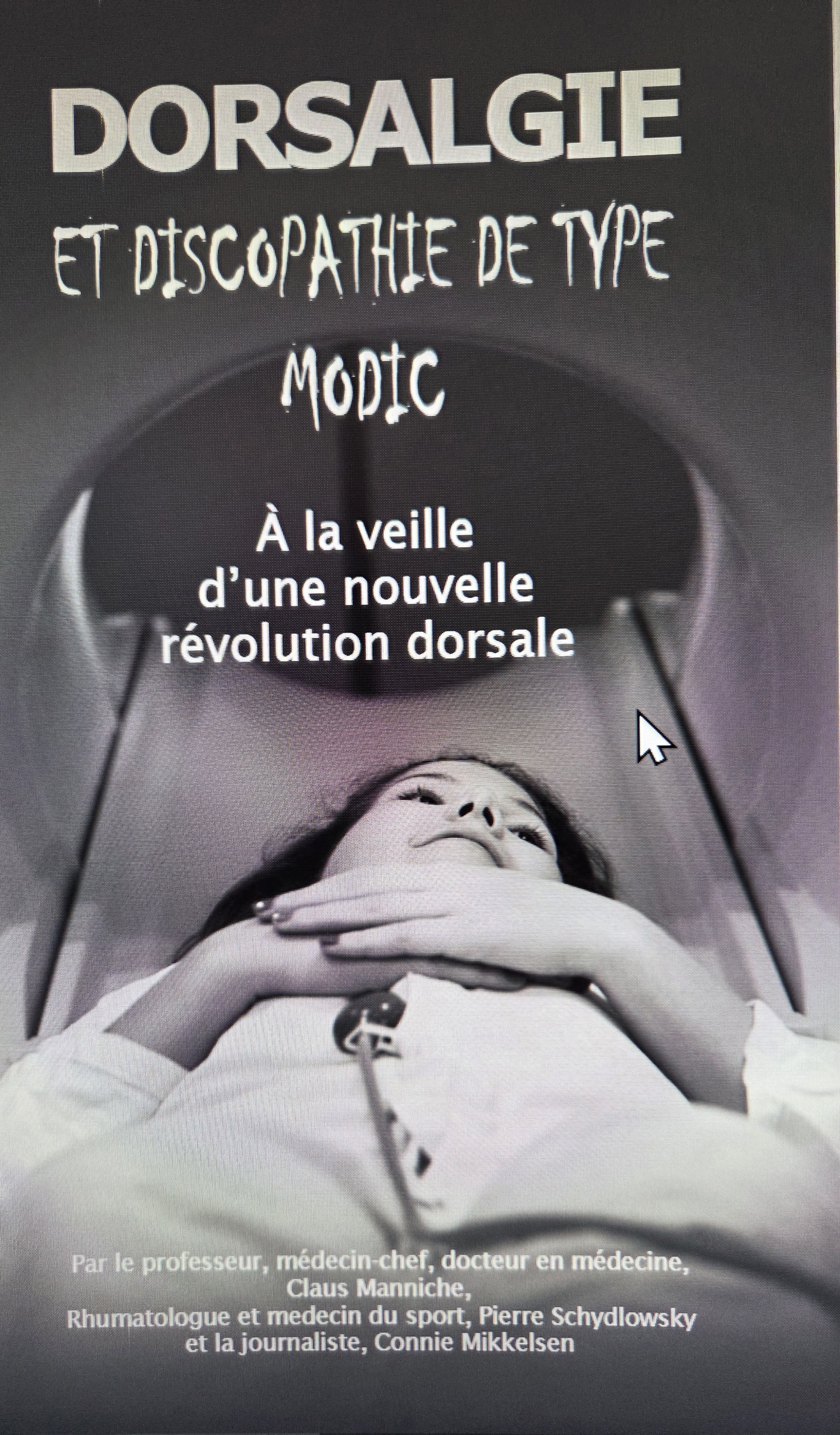 Dorsalgie et discopathie de type Modic